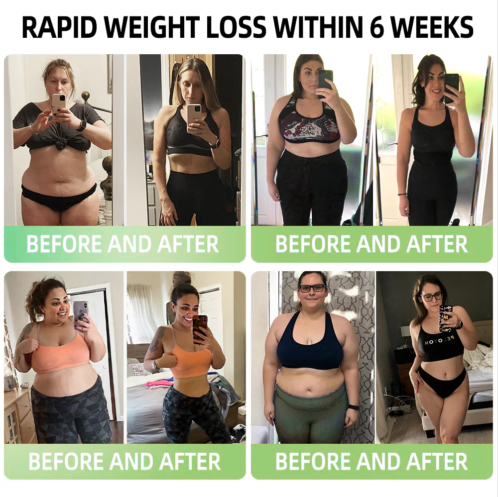 Cvreoz® GLP-1 Slimming & Health Boost Drops 2.0(🏆Powerful GLP-1 Fat Burner | ✅addressing diabetes, obesity, and cardiovascular diseases| ✅Natural Weight Loss & Energy Balance)🔴