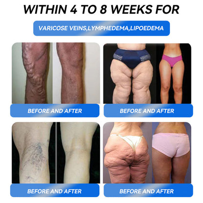 Cvreoz® GLP-1 Inspired Metabolic Reset Drops ✅One dose a day — see results in 7 days👩‍⚕️Suitable for obesity, cardiovascular diseases, diabetes, sleep apnea, high cholesterol and blood lipids, joint problems, and various other conditions🔴