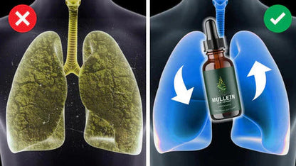 🚨🚨 FLASH SALE: Upgrade to VIP Lungs health NOW – 50% Off ⏳ (Only 72 Hours Left!)-【✨Recharge Your Vitality with  𝐌𝐮𝐥𝐥𝐞𝐢𝐧 𝐋𝐞𝐚𝐟 𝐑𝐞𝐬𝐩𝐢𝐫𝐚𝐭𝐨𝐫𝐲 𝐃𝐫𝐨𝐩𝐬】